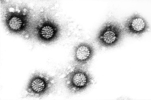 လူ့ papillomavirus